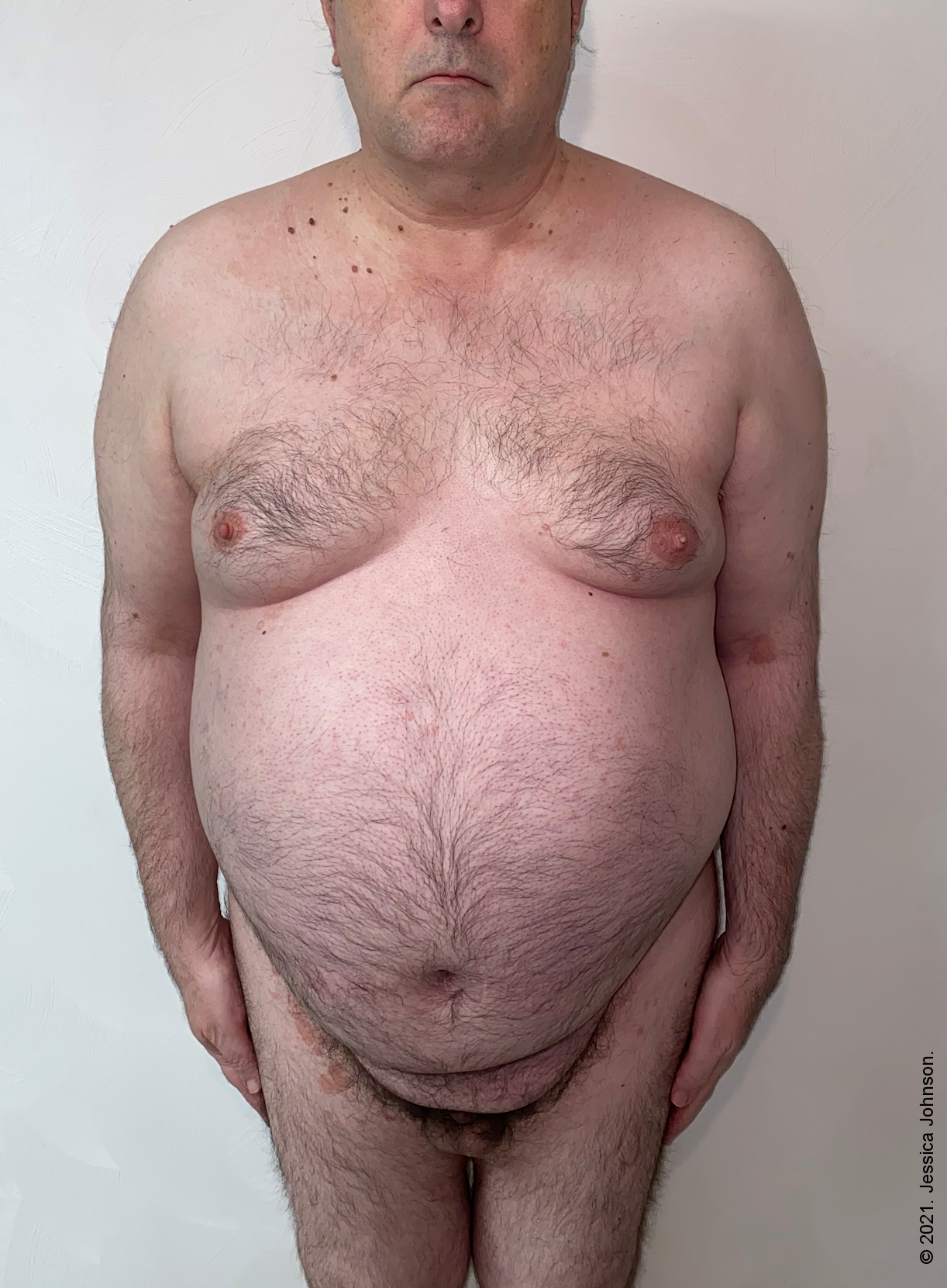 Phillip's Small Penis Humiliation and Shame.